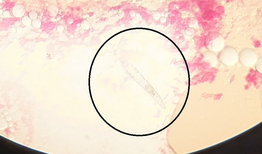 Demodex